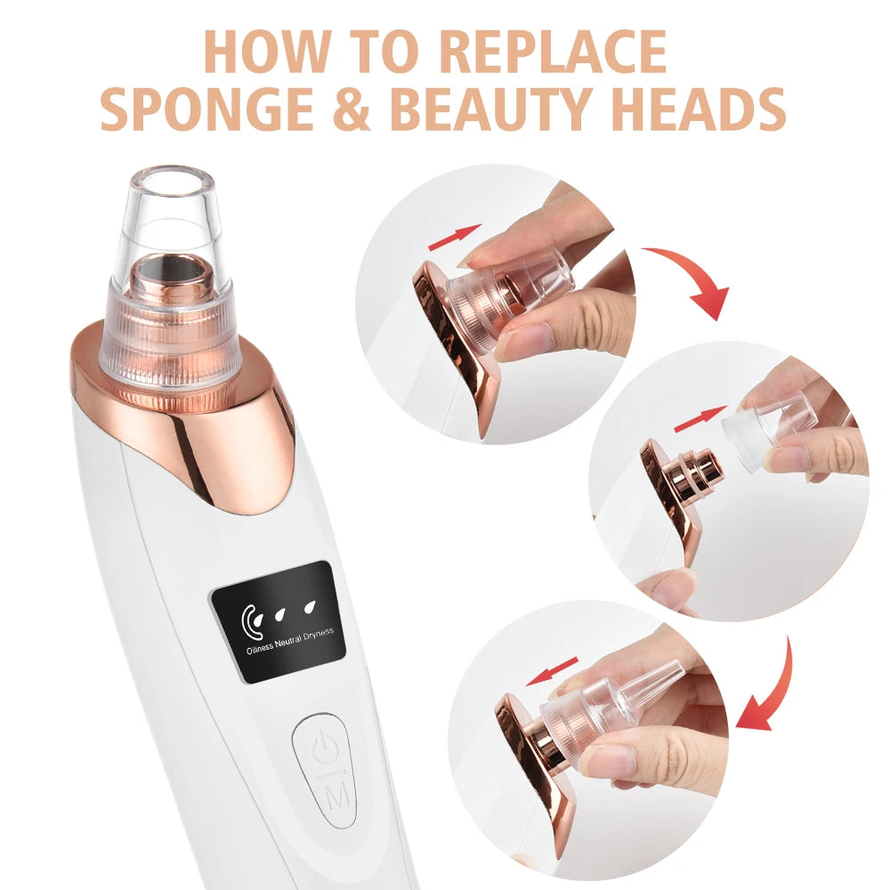 UltraSuction Blackhead Remover - Rechargeable Pore Vacuum & Facial Cleanser