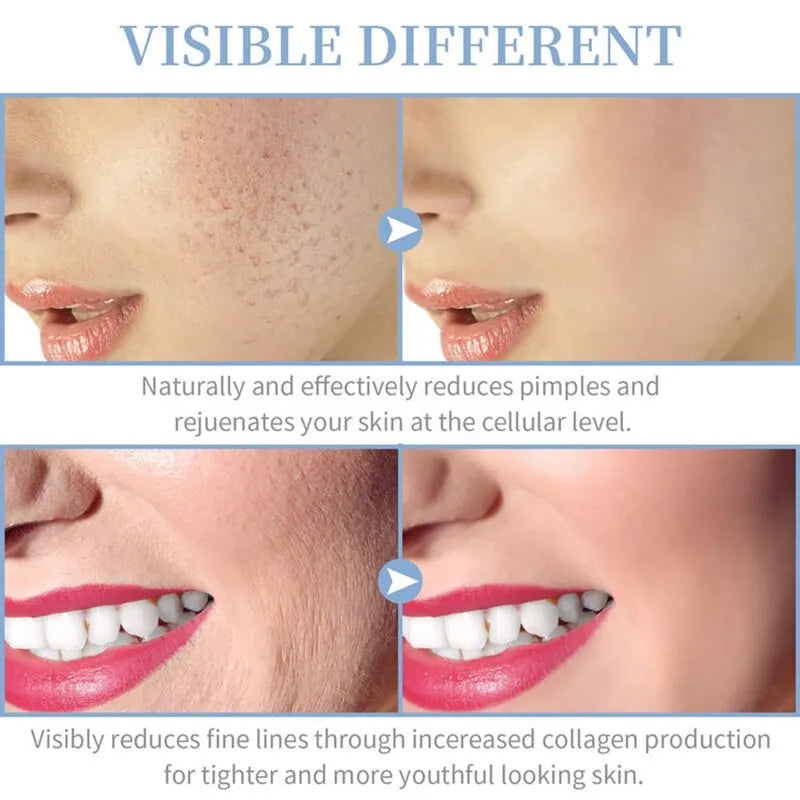 Advanced High Frequency Skin Therapy Wand - Multifunctional Facial Treatment Device