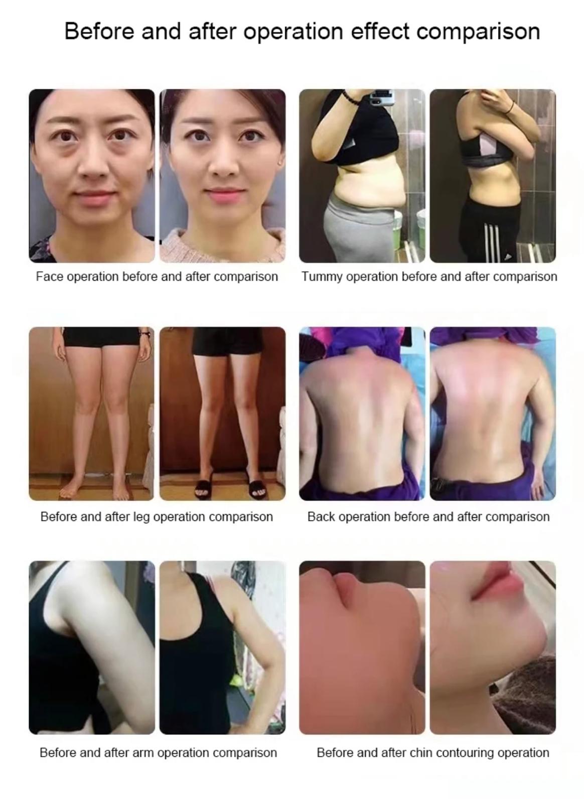 448K Tecar Cavitation RF Slim Machine - Advanced Beauty & Wellness Device